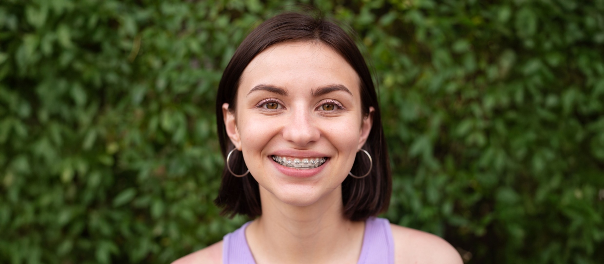 Frenillos Una Solución Atemporal