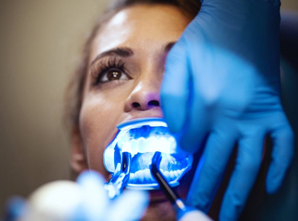 Patient undergoing dental X-ray for orthodontic assessment at FXBright.